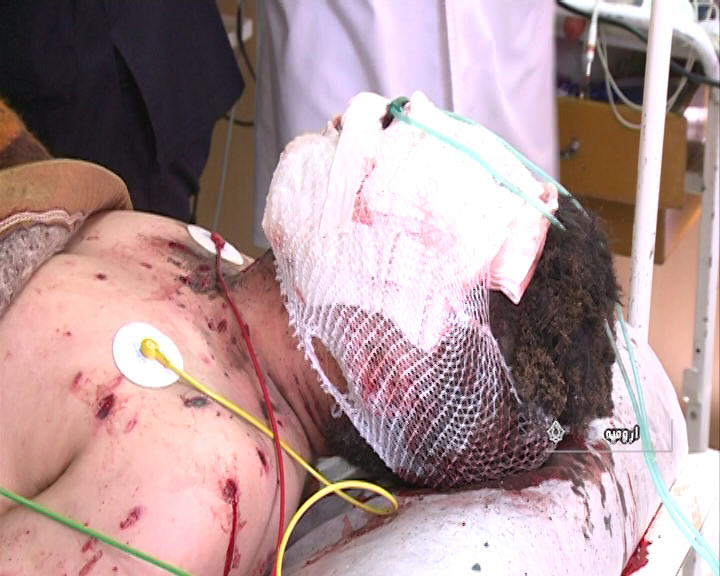 ۲ زخمی بر اثر انفجار مواد محترقه دست ساز در ارومیه