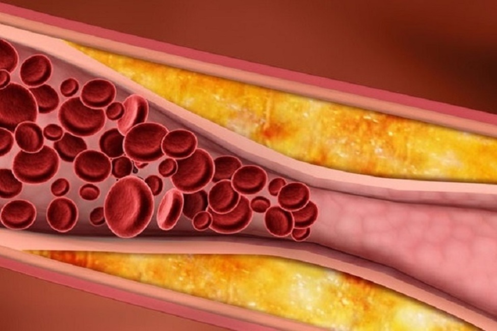 تفاوت کارکرد کلسترول و تری گلیسیرید در بدن چیست؟