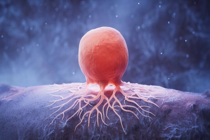 اجرای برنامه جامع غربالگری سرطان در آذربایجان غربی